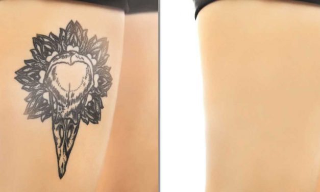 Tattoo Cover Up: The Complete Guide – Permanent and Temporary Solutions